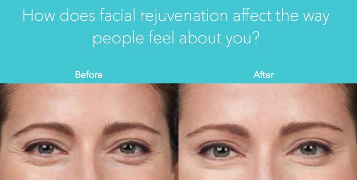 facial rejuvenation in orlando