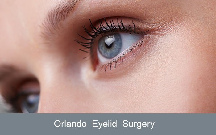 Dr. Brian Haas Provides Orlando Blepharoplasty